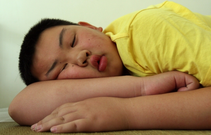 lossofsleepduringadolescenceleadtodiabetes